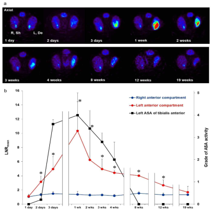 탈신경 근육의 포도당 대사증진 현상의 시간적 특성 (a) 탈신경 후 1, 2, 3 일 및 1, 2, 3, 4, 8, 12, 19 주에 촬영한 백서의 하퇴 중간부위 영상. 경골 및 비골신경 지배근육에서 FDG의 신호가 증가된 것이 관찰됨 (b) FDG 신호의 유의미한 증가는 2 일 후부터 시작되어 12 주까지 지속됨. (LNRmean, sham, 1.332 ± 0.20; , 2.661 ± 0.749, n = 5). 반대로 EMG에서 비정상 자발전위는 3 일에 나타났고 8주에 사라짐. * P <0.05 (Wilcoxon signed-rank tests). R, 우측; L, 좌측; Sh, 가장수술; De, 탈신경; Wks, 주