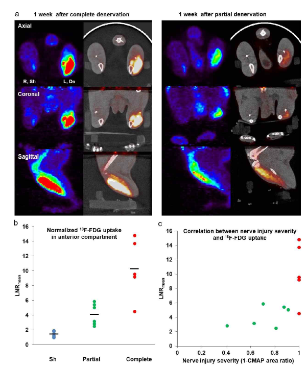 부분적인 비골 손상 모델에서 FDG신호 와 신경손상정도와의 상 관관계 (a) 신경 손상 후 1 주일에 시행한 FDG PET scan에서 부분손상 모델이 완전손상모델에 비해 더 적게 증가함. (b) LNRmean은 부분손 상모델에서 완전손상과 비교하여 약간의 증가된 FDG신호 (LNRmean, 부분, 4.119 ± 1.475, n = 6)를 확인함. (LNRmean, complete, 10.340 ± 4.094, n = 5 ). (C) 신경 손상의 정 도는 FDG 신호강도와 강하게 상관관계를 보임. (Pearson correlation coefficient 0.63, P <0.05)