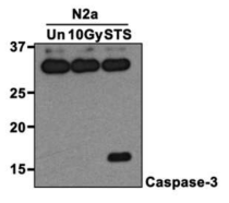 γ-radiation 처리 신경모세포주(N2a)의 caspase 3 패턴