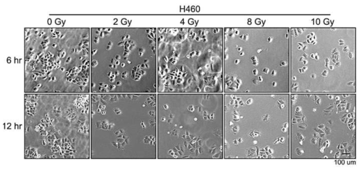 H460 폐암세포주에 여러 dose의 방사선 노출 비교