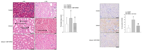 조영제 유발 신병증 마우스 모델에서 신장 손상의 호전과 활성 산손종의 조직에서 감소