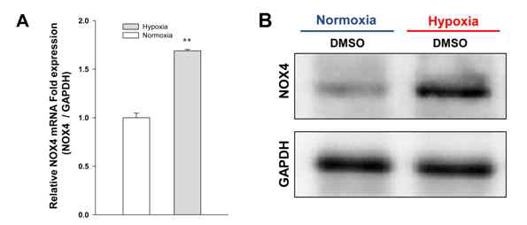 허혈에 의한 급성 신손상 모델에서 Nox4 의 상승