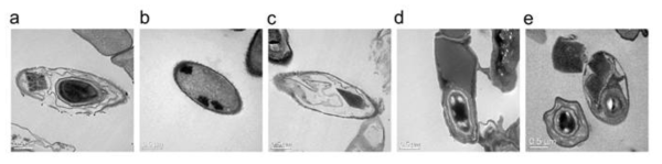 Transmission electron microscopy images of parasporal crystals of (A) KCTC 1014, (B) KCTC 3452, (C) KCTC 1511, (D) KCTC 1507, and (E) KCTC 1316