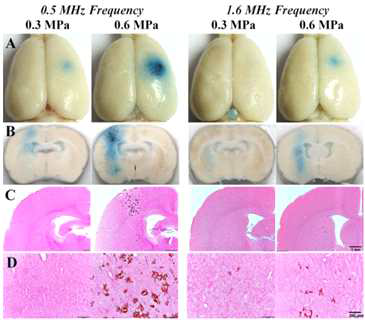 초음파 frequency와 acoustic pressure 변화에 따른 뇌혈관장벽 개방 및 손상 비교