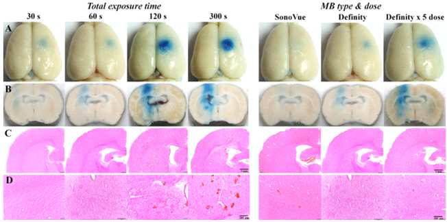 total exposure time과 microbubble type, dose에 따른 뇌혈관장벽 개방 및 손상 비교