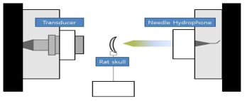 두개골 투과후의 음장 및 음압 측정 실험 구성