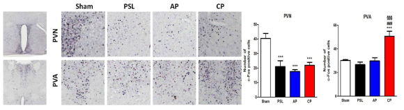 대뇌 신경세포 활성도 관찰. PVN, paraventricular hypothalamic nucleus; PVA, paraventricular thalamic nucleus anterior. ***p<0.001 vs. Sham, ###p<0.001 vs. PSL, §§§p<0.001 vs. CP