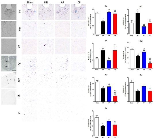 대뇌신경세포 활성도 관찰. PV, paraventricular thalamic mucleus poserior; MD, mediodorsal thalamic nucleus; VP, ventral posterior thalamic nucleus, Cg1, cingulate cortex; M2,secondary motor cortex; DL,caudate putamen-dorsal lateral; VL, caudate putamen-ventral lateral. *p<0.05, ***p<0.001 vs. Sham, #p<0.05, ##p<0.01, ###p<0.001 vs. PSL, §p<0.05, §§p<0.01 vs. AP