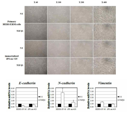 불멸화된 상피세포주의 Epithelial-mesenchymal transition 유도