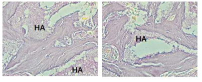 iPSC유래 상피유사세포주와 neural crest 유래 중간엽줄기세포의 in –vivo 분화