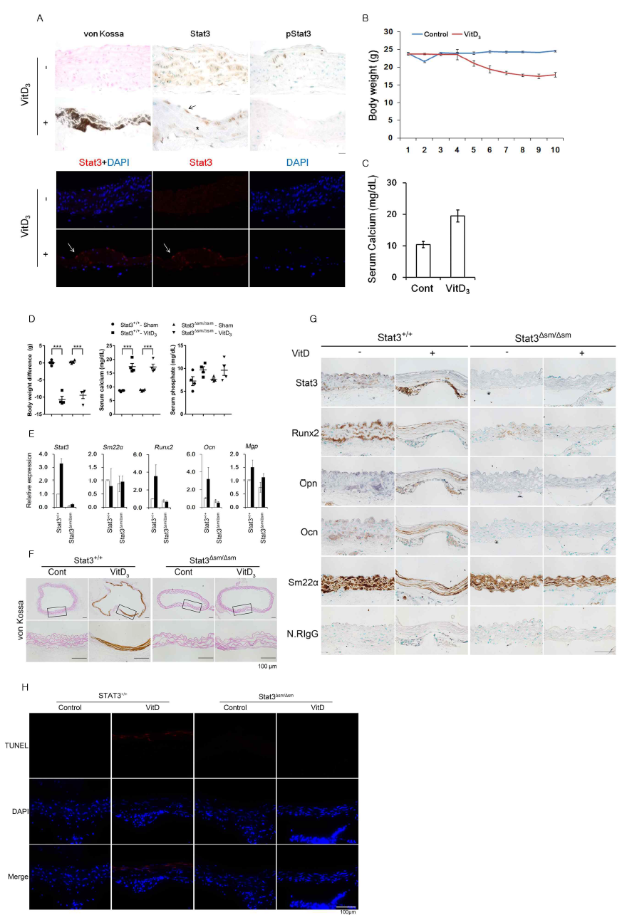 석회화된 혈관에서 Stat3의 발현 확인 및 Stat3Δsm/Δsm에서 혈관석회화 억제 검증