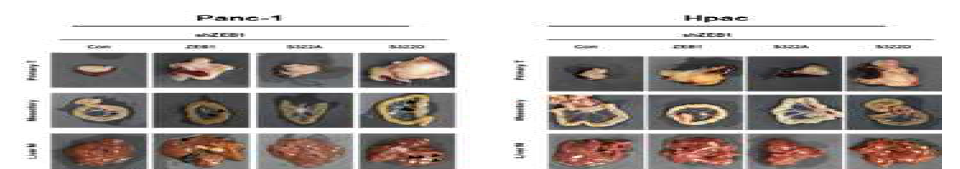 NOD/SCID 마우스에 ZEB1S322를 주입시킨 PANC-1과 HPAC세포주를 췌장에 주입후 췌장, 장간막, 간의 표현