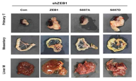 NOD/SCID 마우스에 ZEB1S887를 주입시킨 PANC-1과 HPAC세포주를 췌장에 주입후 췌장, 장간막, 간의 표현형 분석