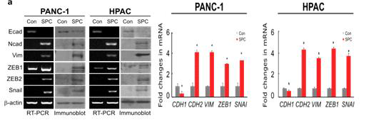PANC-1과 HPAC 세포주에서 SPC에 의한 EMT 변화 (RT-PCR, Immunoblot, real-time PCR)
