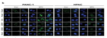 PANC-1과 HPAC 세포주에서 SPC에 의한 EMT 변화 (면역세포화학염색)