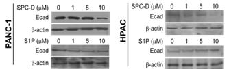 PANC-1과 HPAC 세포주에서 SPC과 S1P에 의한 EMT 변화 (Immunoblot)