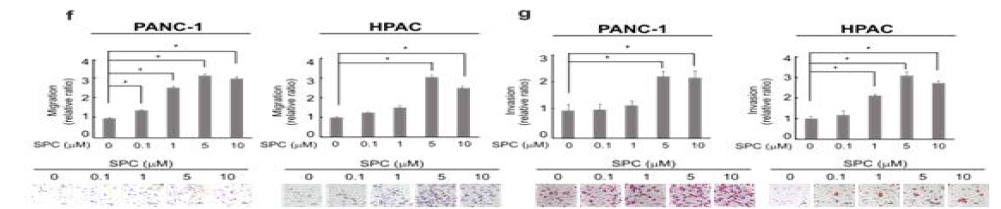 PANC-1과 HPAC 세포주에서 SPC의한 EMT 세포이동과 침윤 능력