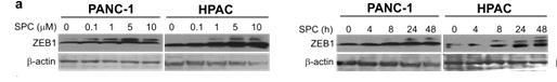 PANC-1과 HPAC 세포주에서 SPC에 의한 ZEB1의 번역 후 변형(post-translational modification (PTM))