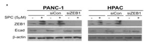 ZEB1 유전자를 결여시킨 PANC-1과 HPAC 세포주에서 SPC의한 EMT 변화 (Immunoblot)