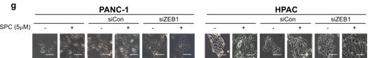 ZEB1 유전자를 결여시킨 PANC-1 세포주에서 SPC의한 세포모양변화