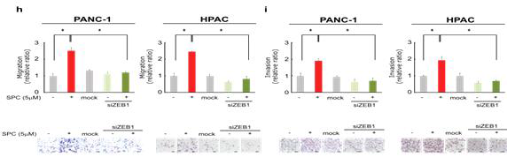 ZEB1 유전자를 결여시킨 PANC-1 세포주에서 SPC의한 EMT 세포이동과 침윤 능력