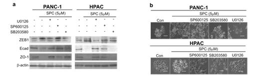 신호전달 억제제를 처리한 PANC-1과 HPAC세포주에서 SPC의한 EMT 변화 (Immunoblot) 및 세포모양변