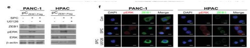 ZEB1을 과발현 한 후 U0126을 처리한 PANC-1과 HPAC 세포주에서 SPC의한 ZEB1과 ERK의 인산화