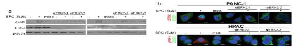 ERK1과 ERK2 유전자를 결여시킨 PANC-1과 HPAC 세포주에서 SPC의한 ZEB1과 ERK의 인산화