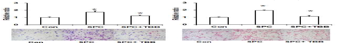 TBB을 처리한 PANC-1 세포주에서 SPC의한 EMT 세포이동과 침윤 능력