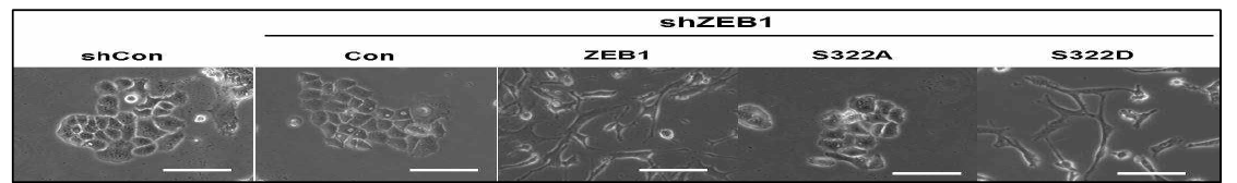 ZEB1의 PTM에 관여하는 S322이 EMT현상에 미치는 영향