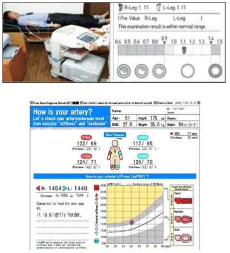 상완-발목 맥파 속도 검사 및 결과 해석