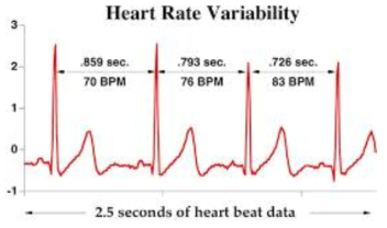 심박수 변이도 개념