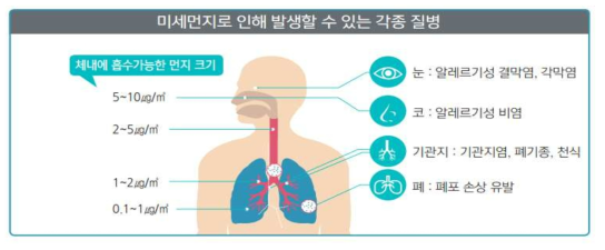 미세먼지로 인해 발생할 수 있는 각종 질병