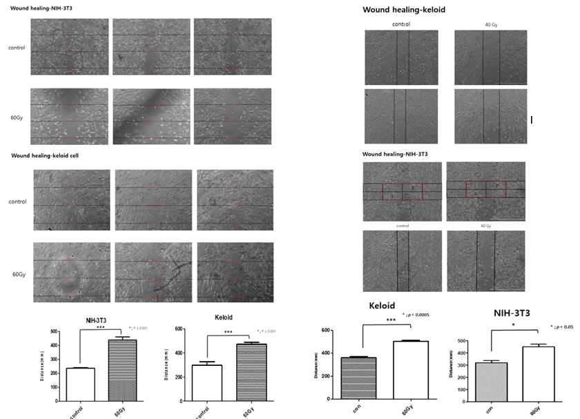 근접치료장비를 이용한 wound healing assay(좌), 라이낙 방사선치료 장비를 이용한 wound healing assay(우)