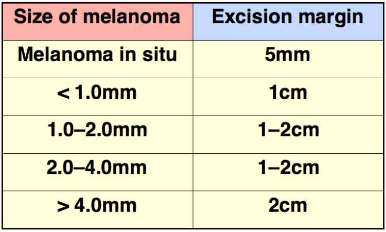 피부암 크기에 따른 추천 제거범위