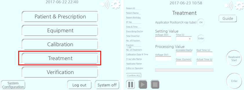X-선 근접치료기기 Treatment 화면