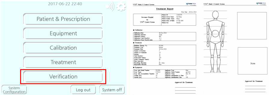 X-선 근접치료기기 Verification & Treatment report