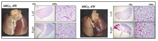 왼쪽 폐 전체에 60 Gy 방사선 조사 후 4주 (왼쪽), 6주 (오른쪽) 후의 마우스 폐의 Gross 및 H&E staining 결과