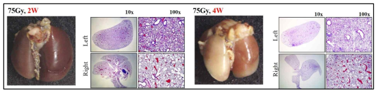 왼쪽 폐 전체에 75 Gy 방사선 조사 후 2주 (왼쪽), 4주 (오른쪽) 후의 마우스 폐의 Gross 및 H&E staining 결과