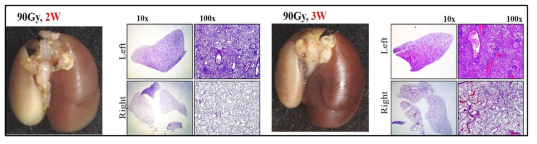 왼쪽 폐 전체에 90 Gy 방사선 조사 후 2주 (왼쪽), 3주 (오른쪽) 후의 마우스 폐의 Gross 및 H&E staining 결과