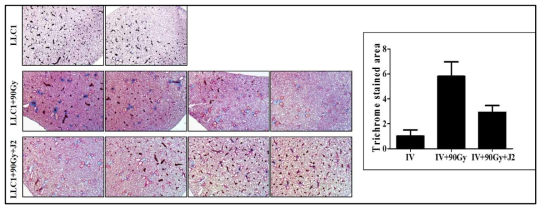orthotopic mouse lung cancer model에서 방사선 조사의 종양영향 및 방사선 폐섬유화 영향 상호작용 및 상관성 분석을 위한 Masson′s Trichrome staining 결과