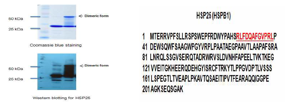 비정상적 HSP25 이형화 밴드의 mass 분석에 의한 HSP25 단백 분석