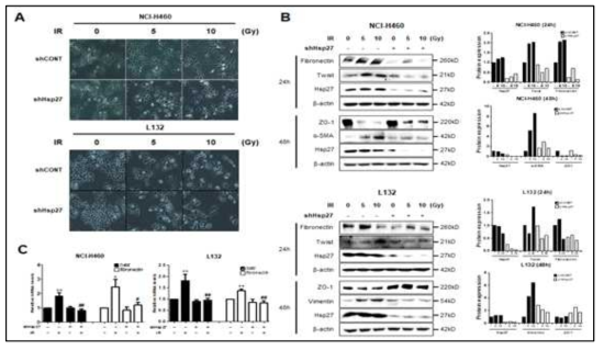 HSP27 knockdown에 의한 EMT 마커의 발현 변화. L132 lung fibroblast 및 NCI-H460 lung adenocarcinoma cell에서 HSP27을 knock down (shHSP27) 시킨 후 방사선 (5Gy 및 10Gy) 처리에 의한 Western blotting과 real time RT-PCR을 통한 확인 (L132 세포-우, NCI-H460–좌)