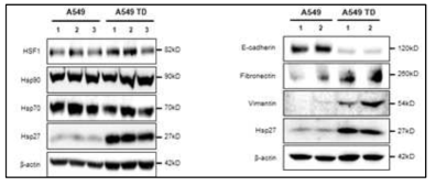 A549 페암세포에 TGFbeta를 지속적으로 처리하였을 때 HSPs의 발현 및 EMT marker의 발현을 Western blotting으로 확인