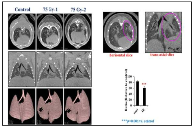 Micro-CT 촬영을 통한 폐손상 평가 시스템 구축. 75Gy선량으로 6주간 방사선을 처리한 마우스. Top row : horizontal slice orientation. Middle row : trans-axial slice orientation. Bottom row : images of 3D micor-CT. 왼쪽 폐를 대상으로 Horizontal 또는 trans-axial orientation에서 consoldiation부분을 제외한 정상 폐조직의 volume을 측정한 결과 75Gy 6주 방사선 조사된 그룹에서의 정상 폐 볼륨이 감소됨을 확인함