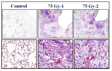 Trichrome 염색을 통한 폐렴, 폐섬유화 손상평가 시스템 구축. H&E stain과 동일하게 paraffin을 제거한 뒤, Masson’s Trichrome 염색하여 collagen 침착을 관찰함. 75 Gy 방사선 조사된 그룹에서는 control 그룹에 비해 intensive하게 collagen이 침착되어 있어 섬유화가 진행되었음이 관찰됨