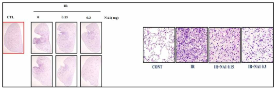 방사선 75 Gy 조사후 HSP27 저해제 선도물질 NA1의 용량별 (0.15, 0.3 mg) 폐조직의 H&E staining. 마우스에서 적출한 폐조직을 관찰하기 위해 10% formaldehyde를 이용하여 고정시킨후 H&E staining 하여 관찰함. 좌 (10x) 우 (400x)