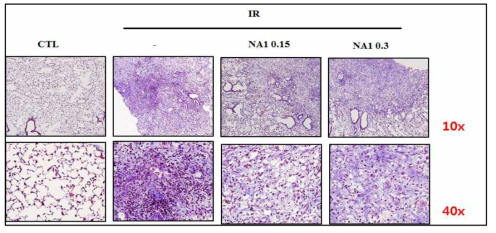 방사선 75 Gy 조사후 HSP27 저해제 선도물질 NA1의 용량별 (0.15, 0.3 mg) 폐조직의 MT staining. 마우스에서 적출한 폐조직을 관찰하기 위해 10% formaldehyde를 이용하여 고정시킨 후 collagen 침착 특이 염색인 MT staining 하여 관찰함