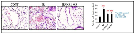 H&E 염색을 통한 폐섬유화-Arterial wall thickness 측정. 75 Gy 6주 후 H&E 염색을 통한 Arterial wall thickness 측정 결과 75 Gy 방사선 조사된 그룹에서는 혈관벽의 두께가 증가되어 있음을 확인하였음. 또한 NA1 0.3 mg에서 혈관벽의 두꺼워지는 것을 blocking함을 확인함