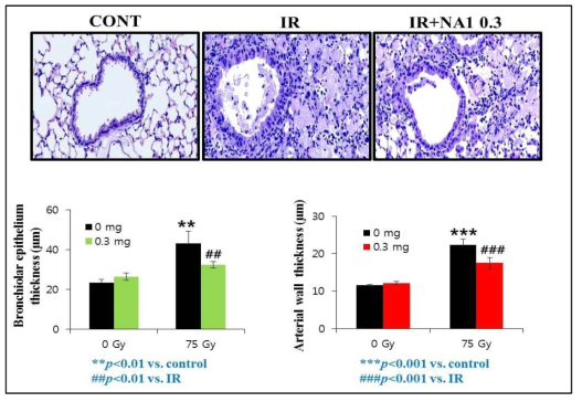 H&E 염색을 통한 폐렴 bronchiolar epithelium thickness, Arterial wall thickness 측정. 75 Gy 2주 후 H&E 염색을 통한 bronchiolar epithelium thickness, Arterial wall thickness 측정 결과 75 Gy 방사선 조사된 그룹에서는 혈관벽의 두께가 증가되어 있음을 확인하였음. 또한 NA1 0.3 mg에서 혈관벽의 두꺼워지는 것을 blocking함을 확인함